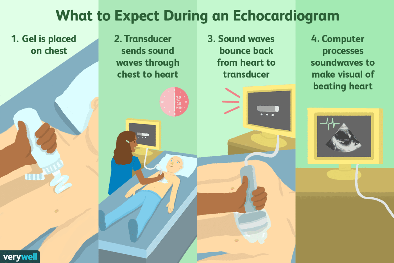 Echocardiogram: Uses, Side Effects, Procedure, Results