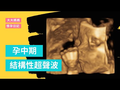 【懷孕日記－孕中期】結構性超聲波 (全實錄) Fetal Morphology Scan